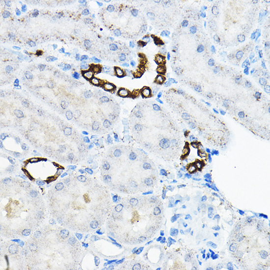 EVA1A Rabbit polyclonal antibody