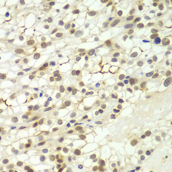 LHX4 Rabbit polyclonal antibody