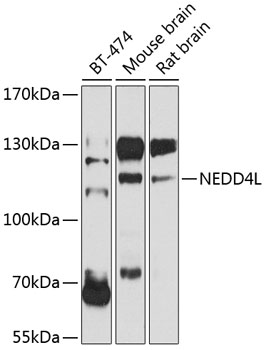 NEDD4L Rabbit polyclonal antibody
