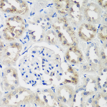 NEDD4L Rabbit polyclonal antibody