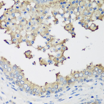 NEDD4L Rabbit polyclonal antibody