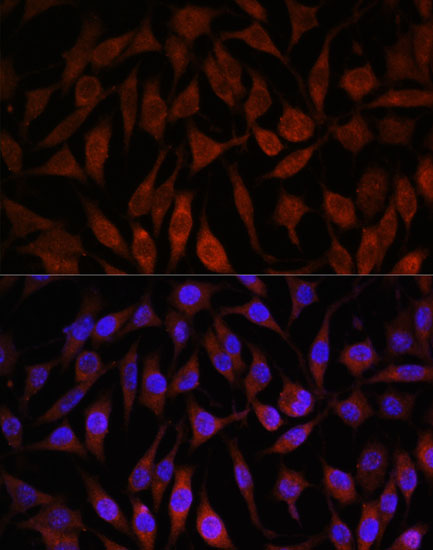 NEDD4L Rabbit polyclonal antibody