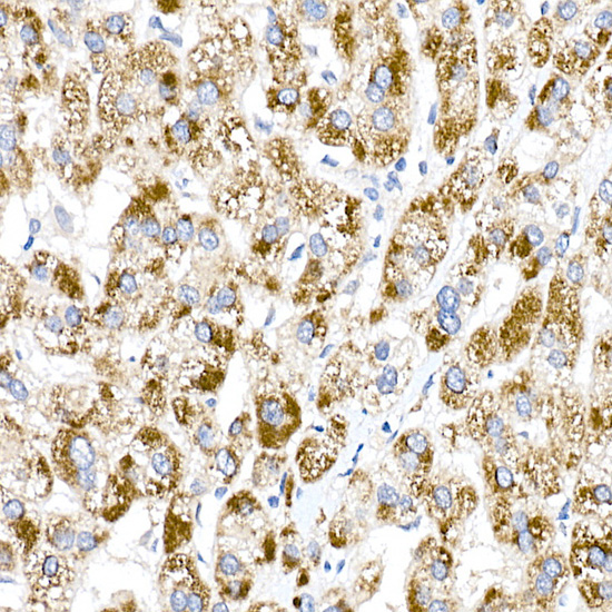 ACOX1 Rabbit polyclonal antibody