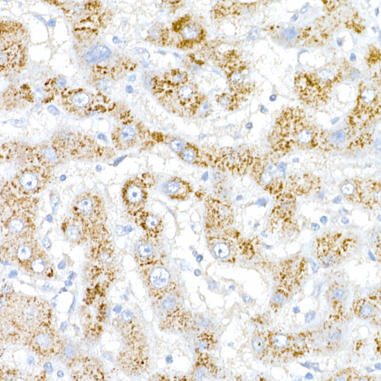 ACOX1 Rabbit polyclonal antibody