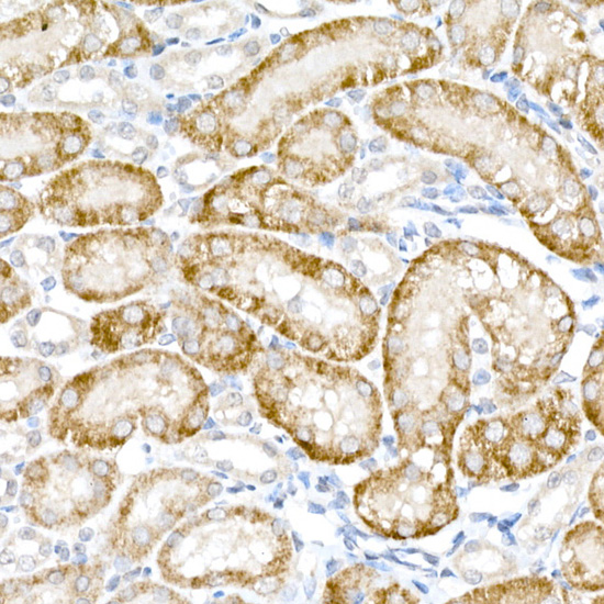 ACOX1 Rabbit polyclonal antibody
