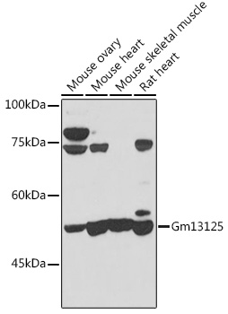 Gm13125 Rabbit polyclonal antibody