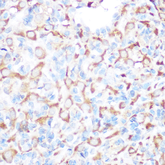 Gm13125 Rabbit polyclonal antibody