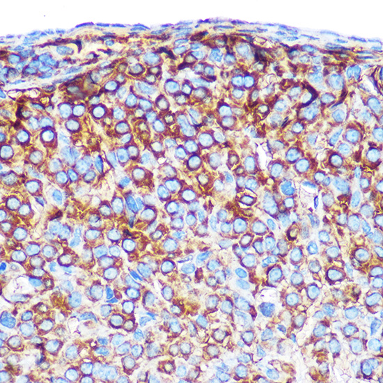 Gm13125 Rabbit polyclonal antibody