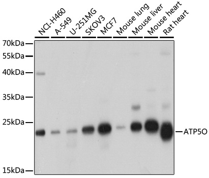 ATP5O Rabbit polyclonal antibody