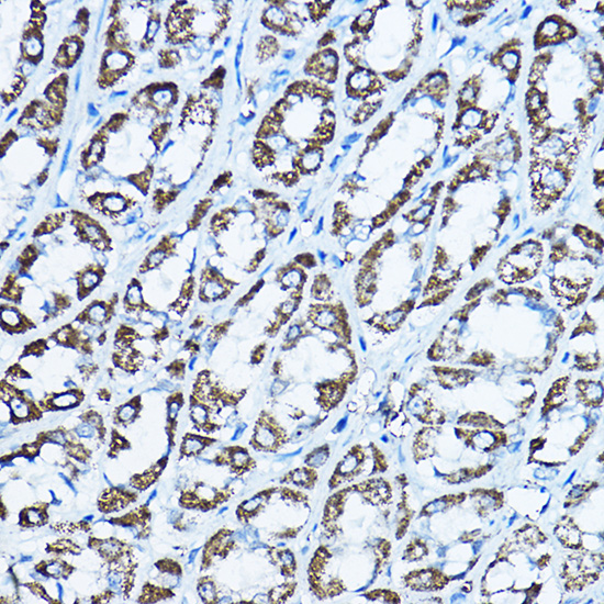 ATP5O Rabbit polyclonal antibody
