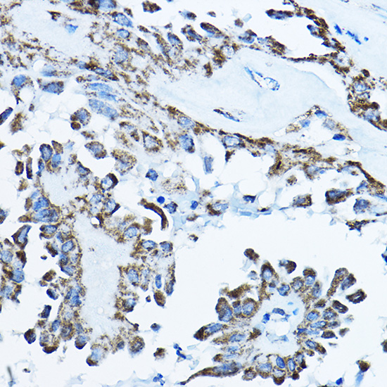 ATP5O Rabbit polyclonal antibody