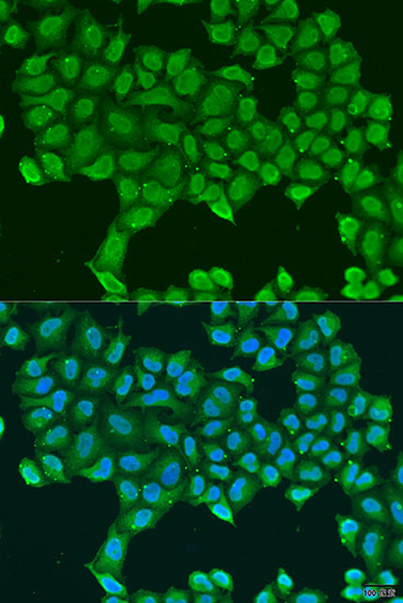 ATP5O Rabbit polyclonal antibody