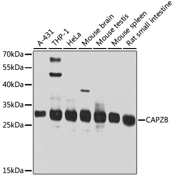CAPZB Rabbit polyclonal antibody