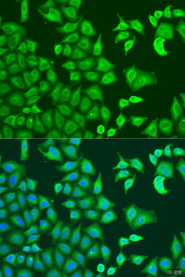 CAPZB Rabbit polyclonal antibody