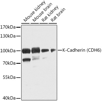 K-Cadherin (CDH6) Rabbit polyclonal antibody