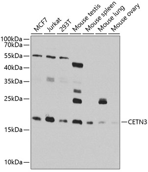CETN3 Rabbit polyclonal antibody