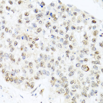 CETN3 Rabbit polyclonal antibody