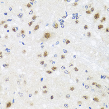CETN3 Rabbit polyclonal antibody
