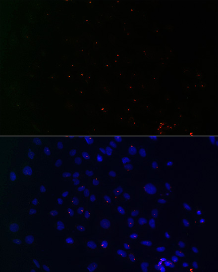 CETN3 Rabbit polyclonal antibody