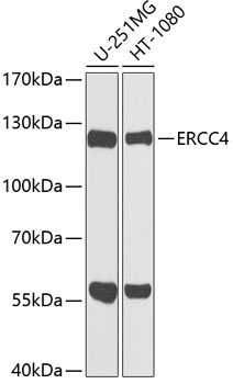 ERCC4 Rabbit polyclonal antibody