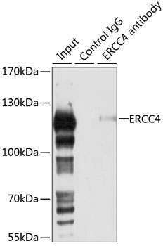 ERCC4 Rabbit polyclonal antibody