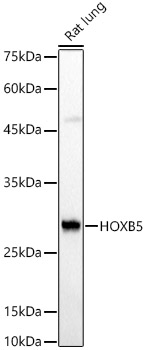 HOXB5 Rabbit polyclonal antibody