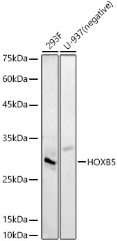 HOXB5 Rabbit polyclonal antibody