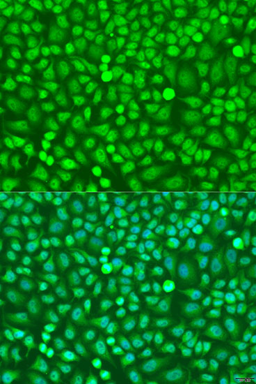 HOXB5 Rabbit polyclonal antibody