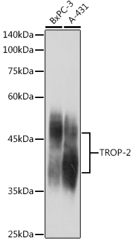 TROP-2 Rabbit polyclonal antibody