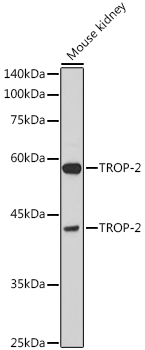 TROP-2 Rabbit polyclonal antibody