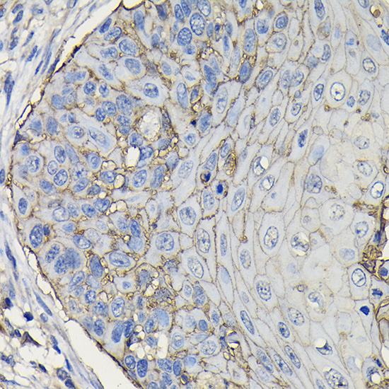 TROP-2 Rabbit polyclonal antibody
