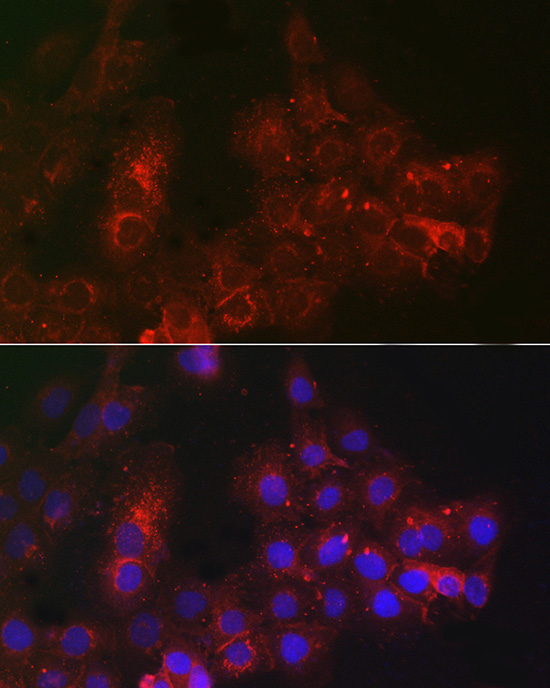 TROP-2 Rabbit polyclonal antibody