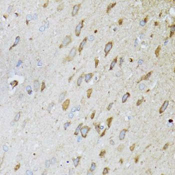 MT-ND5 Rabbit polyclonal antibody