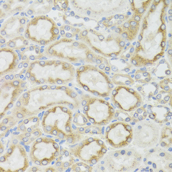 MT-ND5 Rabbit polyclonal antibody