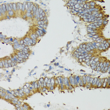 MT-ND5 Rabbit polyclonal antibody