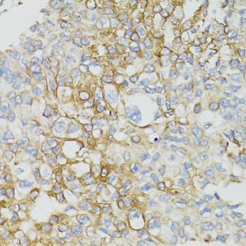 MT-ND5 Rabbit polyclonal antibody