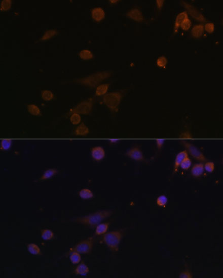NDUFA2 Rabbit polyclonal antibody