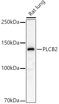 PLCB2 Rabbit polyclonal antibody