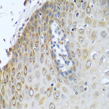 [KO Validated] CYPOR Rabbit polyclonal antibody