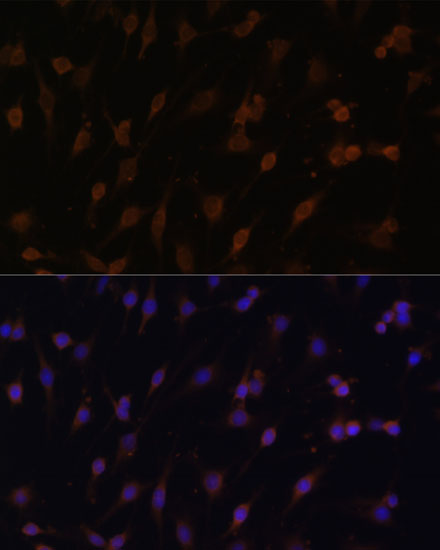 [KO Validated] CYPOR Rabbit polyclonal antibody