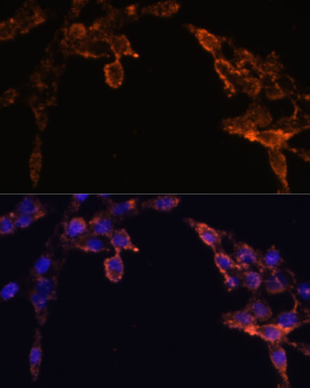 [KO Validated] CYPOR Rabbit polyclonal antibody