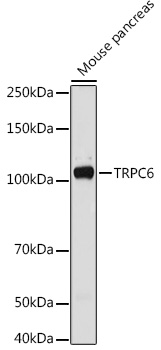 TRPC6 Rabbit polyclonal antibody