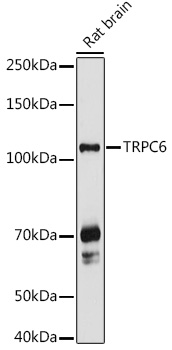 TRPC6 Rabbit polyclonal antibody