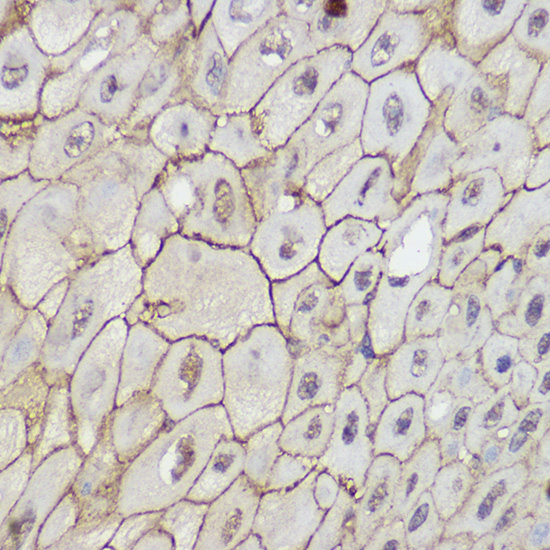 TRPC6 Rabbit polyclonal antibody
