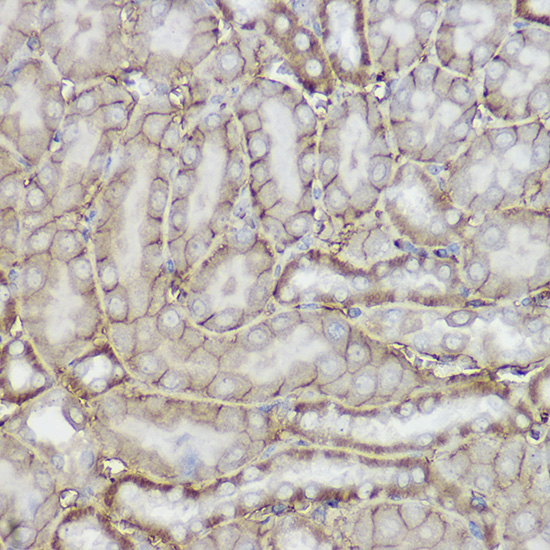 TRPC6 Rabbit polyclonal antibody