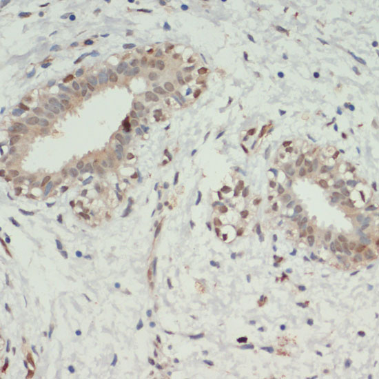 KDM6A Rabbit polyclonal antibody