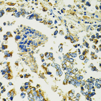 SLC25A11 Rabbit polyclonal antibody