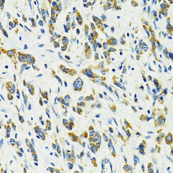 SLC25A11 Rabbit polyclonal antibody