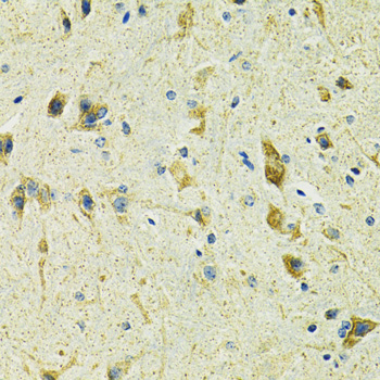 SLC25A11 Rabbit polyclonal antibody