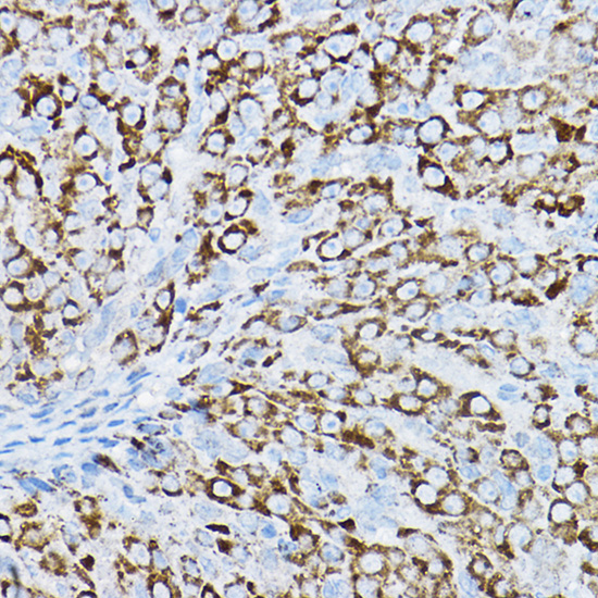 P2RY14 Rabbit polyclonal antibody